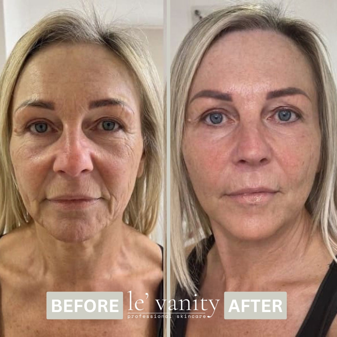 BIO-COLLAGEN MASK